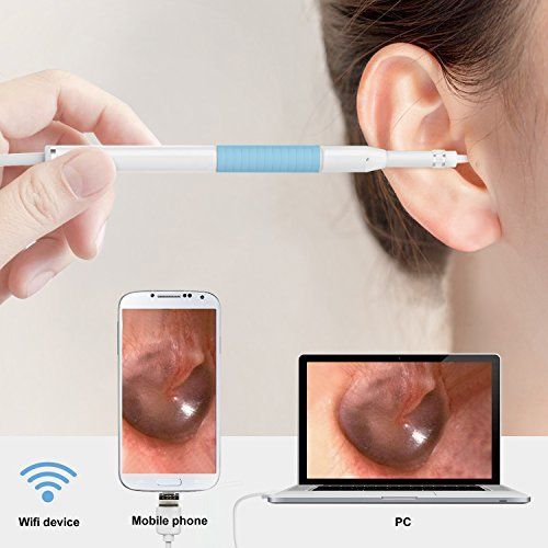 3 In 1 Ear Endoscope 🔥 50% OFF - LIMITED TIME ONLY 🔥