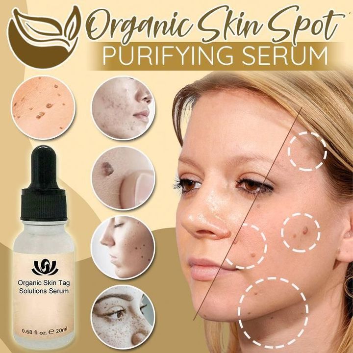 Organic Spot Free Serum 🔥SALE 50% OFF🔥