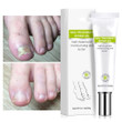 Health Toe Instant Beauty Gel 🔥 50% OFF - LIMITED TIME ONLY 🔥