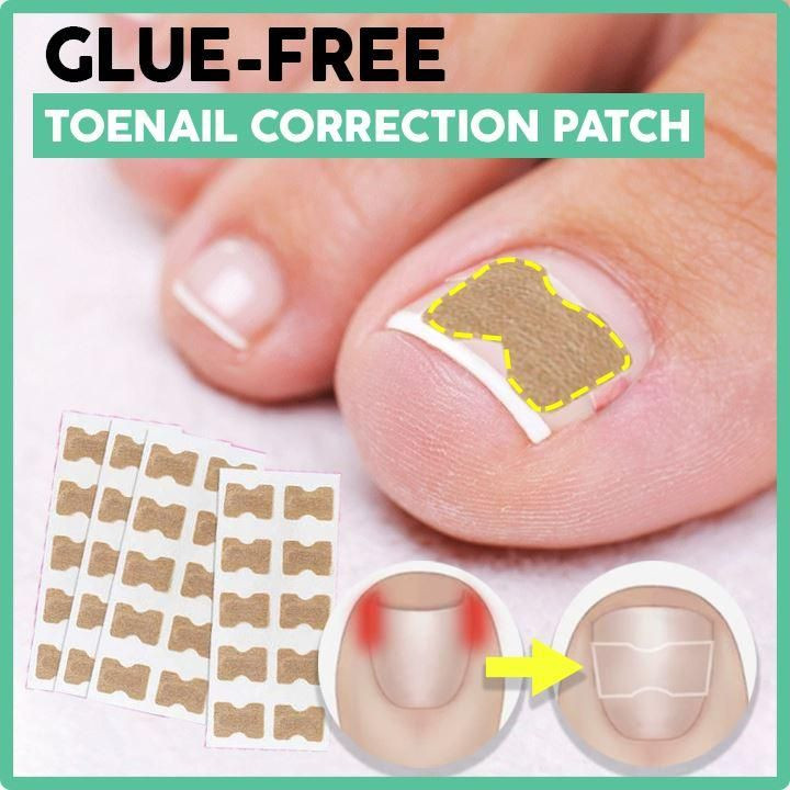 Glue Free Toenail Patch 🔥HOT DEAL - 50% OFF🔥