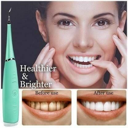 Ultrasonic Toothbrush 🔥50% OFF - LIMITED TIME ONLY🔥