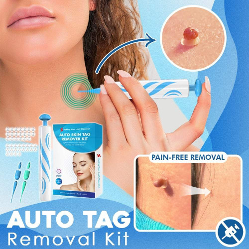 🔥NEW YEAR SALE🔥 Auto Tag Removal Kit