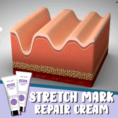 Stretch Mark Repair Cream