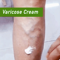 Varicose Veins Repair Cream