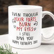 Your Farts Burns My Eyes Mug, I Still Love You Coffee Ceramic Mug, Gift For Dad, Fathers Day Gift