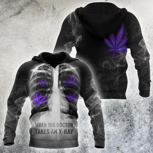 When The Doctor Takes An X-Ray Hippie Passion 3D All Over Printed Hoodie Shirt by SUN AM080401