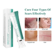H-Scars Formula - All Natural Scar Removal