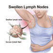 Herbal Lymphatic Detox Patch Underarm Neck Waist Thigh Lymphatic Patch