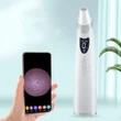 Electric Visual Blackhead Suction Instrument | Pore Cleaner Skin Care Tool