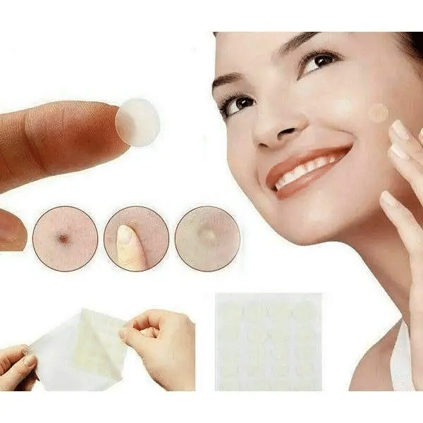 Acne Skin Tag Removal Beauty Patches