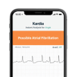 AliveCor KardiaMobile 6-Lead Personal EKG Monitor, FDA-Cleared, Detects Afib
