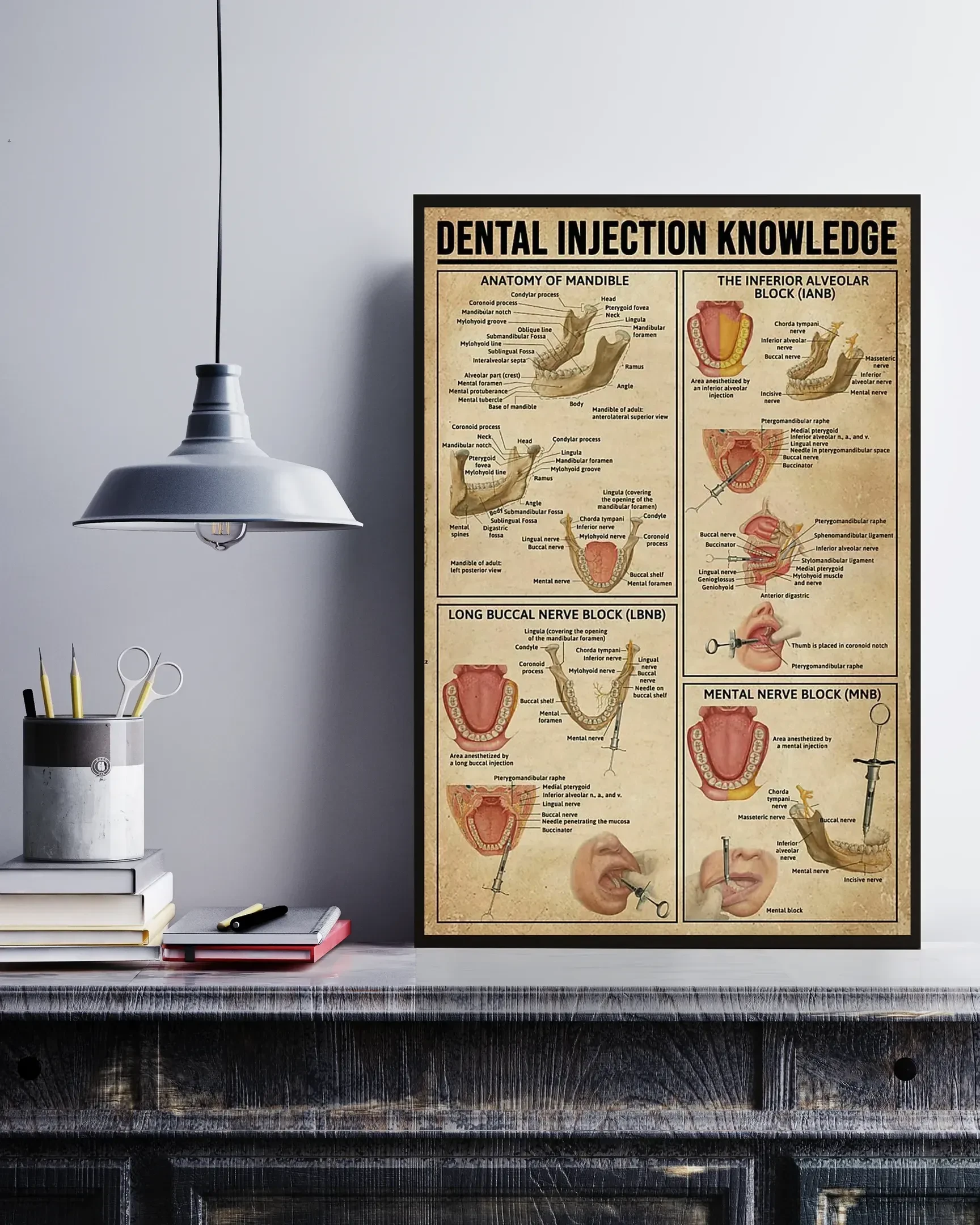 Dental Injection Knowledge Canvas