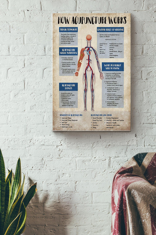 How Acupencture Works Poster - Health Wall Art - Gift For Doctor Anatomy Lover Biologist Canvas Gallery Painting Wrapped Canvas Framed Gift Idea Framed Prints, Canvas Paintings