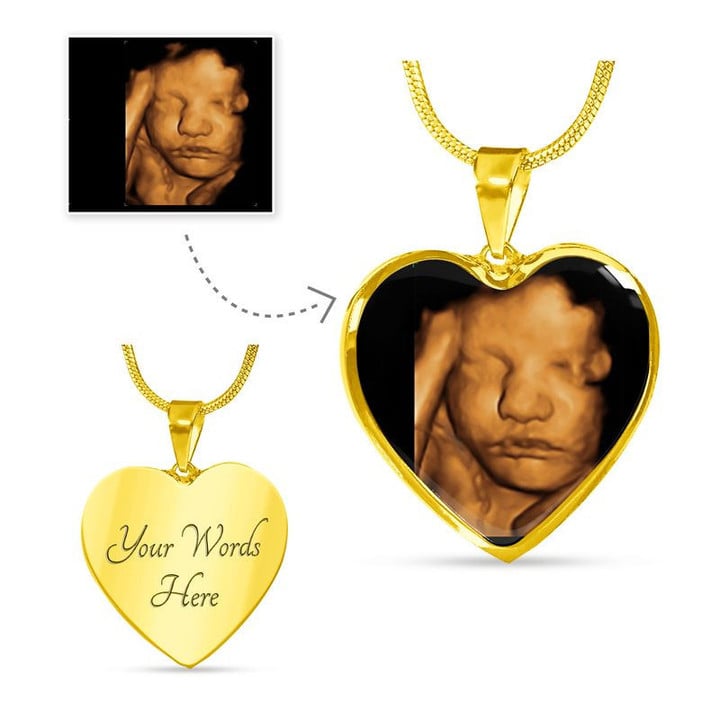 Your Baby's Sonogram Heart Necklace Buyer Upload Luxury Necklace (18k Yellow Gold Finish)