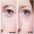 EYELIFTER ™ : Invisible Lift Double Eyelid Stickers