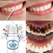 WATEETH™ : Teeth Whitening Water