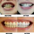WATEETH™ : Teeth Whitening Water