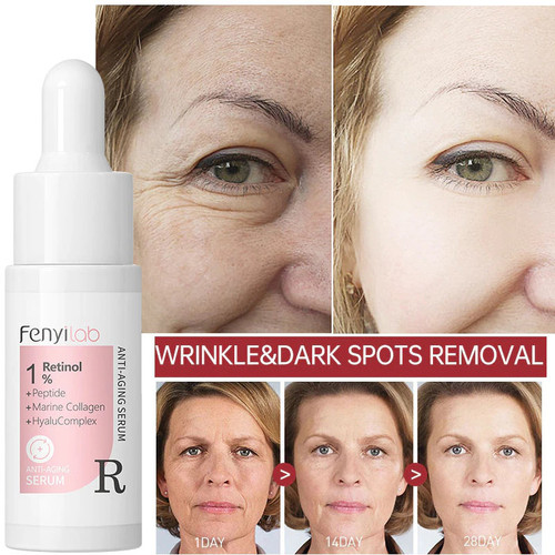 Retinol Anti-Wrinkle Serum for Radiant Skin
