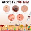 This a discount for you : Clear™ Tags & Moles Remover