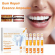 This discount is for you : Gum Repair Treatment Ampoules