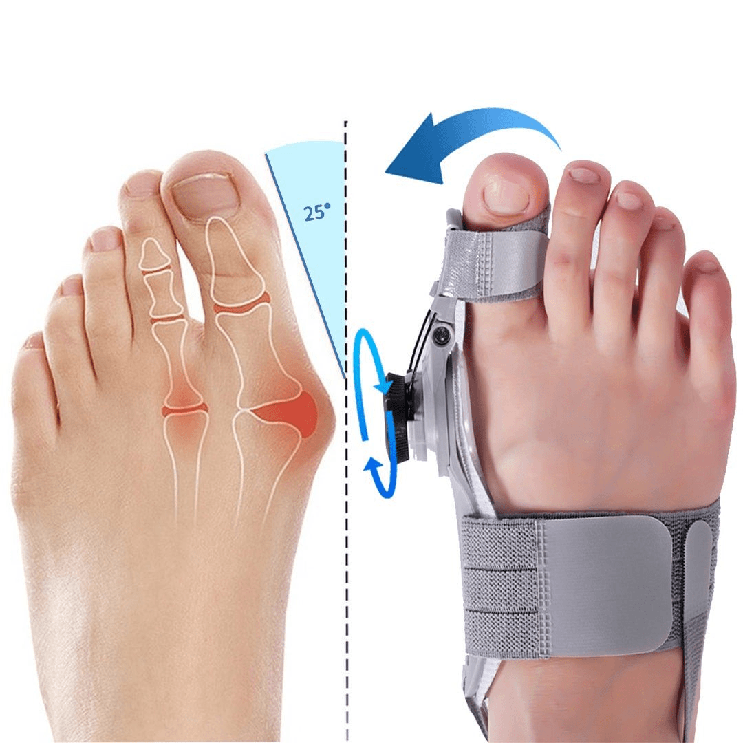 THIS IS A DISCOUNT FOR YOU - Bunion Splint Corrector Big Toe Straightener Unisex Foot Hallux Valgus Braces