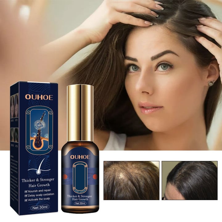 This discount is for you : Polygonum Multiflorum Hair Growth Essence Anti Shedding Dense Hair Fixed Hair Repair Dry Hair Nourishing Essential Oil