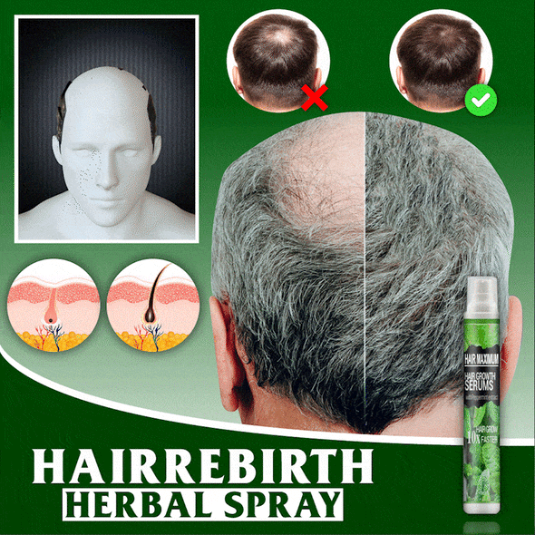 This is a discount for you : 3/1pcs Herbal Essence Hair Growth Spray Serum Anti Hair Loss Products Fast Grow Prevent Hair Dry Damaged Thinning Repair Care