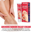 Ointment to relieve joint pain Bunion