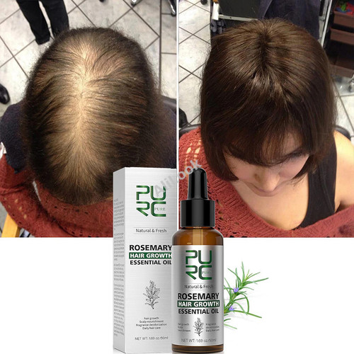 PURC Rosemary Oil Hair Growth Products for Man Women Ginger Anti Hair Loss Fast Regrowth Thicken Oils Scalp Treatment Hair Care