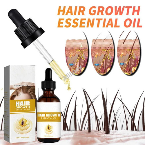 Biotin Fast Hair Growth Oil For Men woman Hair Treatment Baldness Serum Anti-Hair Loss Hair Regrowth Liquid