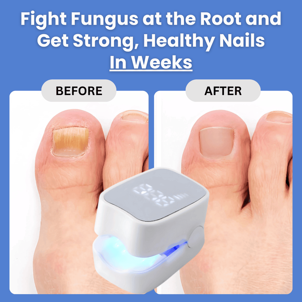 ClearNail Pro - Nail Fungus Laser Device - Coopae
