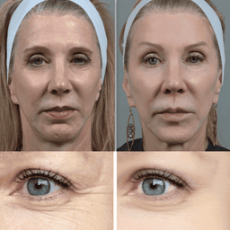 Botanique Paris | Multi-Spectral Facial Rejuvenation Device