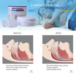 AirFlow™ Mouthpiece