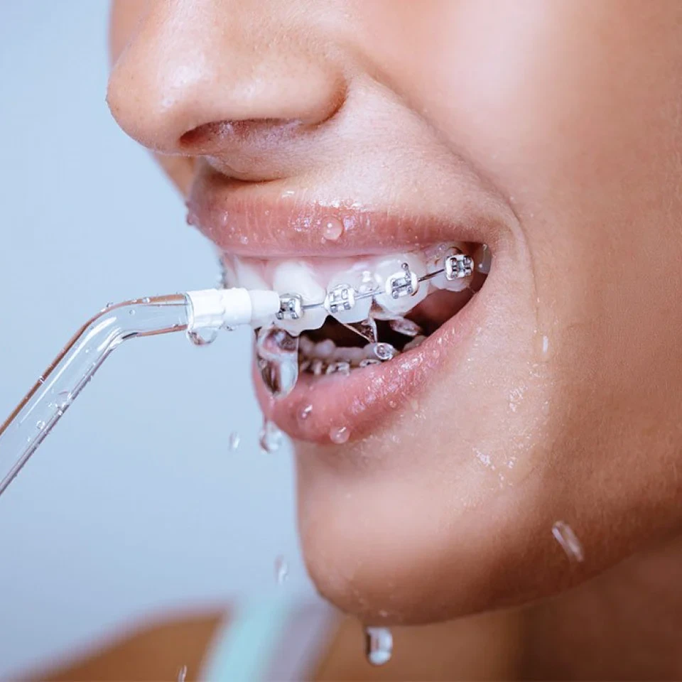Floss Faster, Easier & More Effectively With Wellawhite Water Flosser